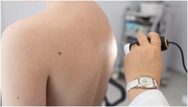 Choosing the Right Skin Check Service